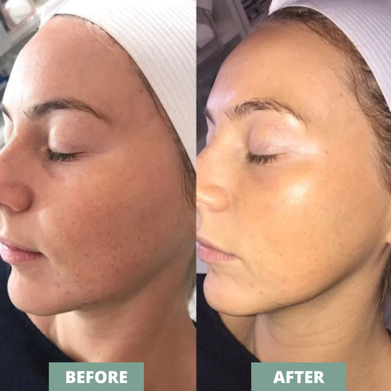 Esfoliante Facial Dermaplane [+BRINDE]