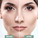 Esfoliante Facial Dermaplane [+BRINDE]