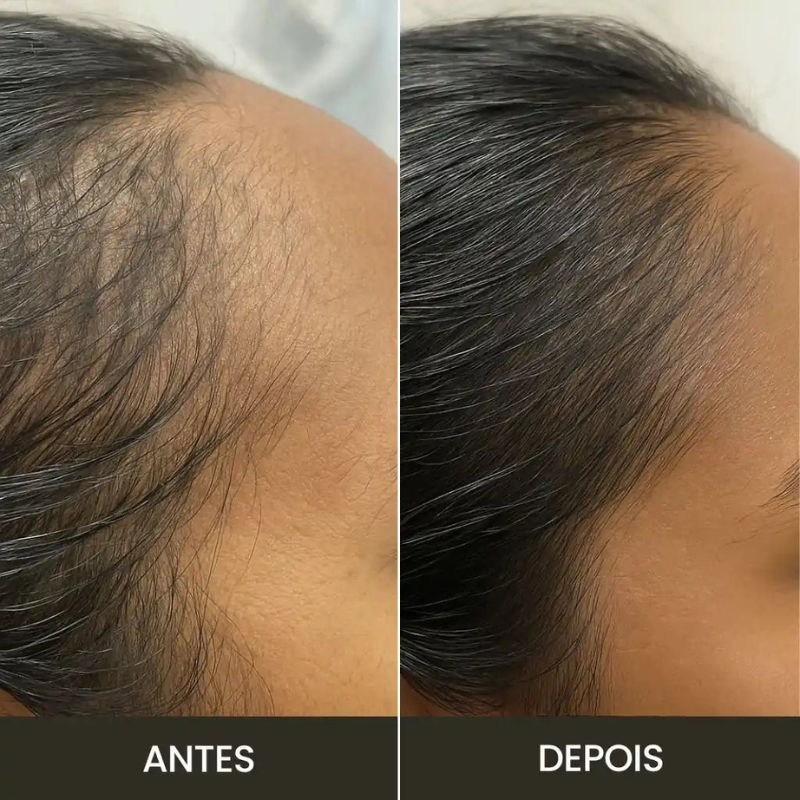 GlowBrush: Escova de Crescimento Capilar [+BRINDE EXCLUSIVO]