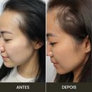 GlowBrush: Escova de Crescimento Capilar [+BRINDE EXCLUSIVO]