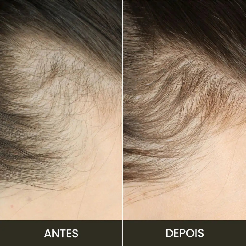 GlowBrush: Escova de Crescimento Capilar [+BRINDE EXCLUSIVO]