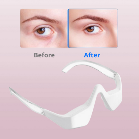 Ollo Eye - Dispositivo Anti-olheira