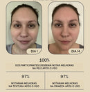 BotoxLaser - Acabe Com as Rugas em 7 dias + BRINDE EXCLUSIVO