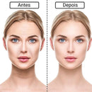 RenovaLift Patches - Acabe Com As Rugas