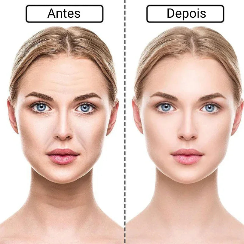 RenovaLift Patches - Acabe Com As Rugas