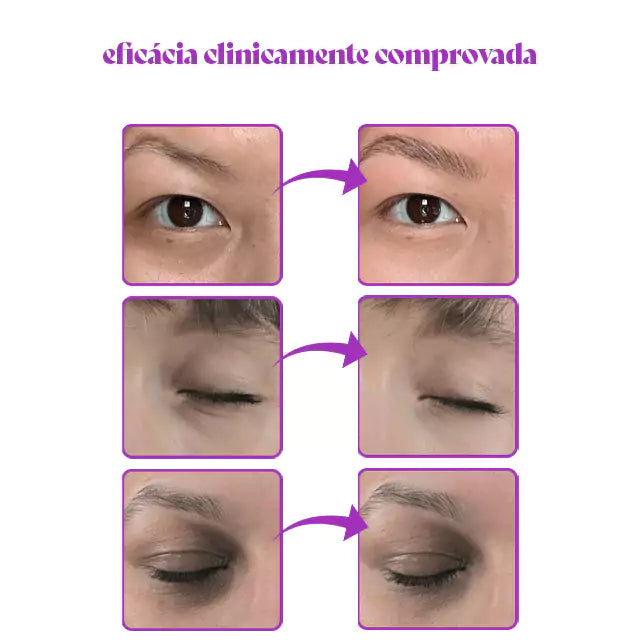Luminous Dior - Corretor de Olheiras Que Revitaliza e Clareia a Região dos Olhos