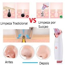Super Clean - Limpeza de pele completa!